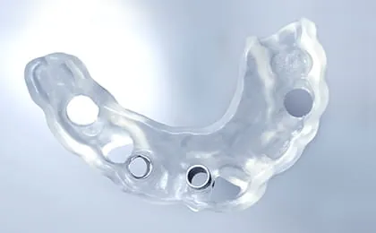 3DプリンタやAIを取り入れた最新の医療技術導入